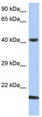 SEC14 Like Lipid Binding 4 antibody, TA333451, Origene, Western Blot image 