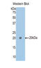 Carboxypeptidase E antibody, LS-C298049, Lifespan Biosciences, Western Blot image 