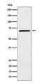 Eukaryotic Translation Initiation Factor 2A antibody, M02418, Boster Biological Technology, Western Blot image 