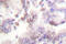 Cyclin Dependent Kinase Inhibitor 2B antibody, LS-C176155, Lifespan Biosciences, Immunohistochemistry frozen image 