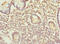 Inositol Hexakisphosphate Kinase 2 antibody, LS-C675910, Lifespan Biosciences, Immunohistochemistry paraffin image 