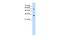 Solute Carrier Family 22 Member 1 antibody, PA5-42043, Invitrogen Antibodies, Western Blot image 