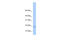 DNA-directed RNA polymerases I and III subunit RPAC2 antibody, 26-346, ProSci, Western Blot image 