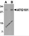 Autophagy Related 101 antibody, 5801, ProSci, Western Blot image 