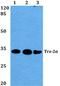 Transformer 2 Alpha Homolog antibody, A03770-1, Boster Biological Technology, Western Blot image 