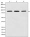 Signal Transducer And Activator Of Transcription 5B antibody, M00681, Boster Biological Technology, Western Blot image 