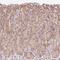 Transmembrane Protein 170B antibody, PA5-63072, Invitrogen Antibodies, Immunohistochemistry paraffin image 