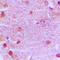MRE11 Homolog, Double Strand Break Repair Nuclease antibody, LS-C352549, Lifespan Biosciences, Immunohistochemistry frozen image 