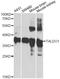 Transaldolase 1 antibody, A6762, ABclonal Technology, Western Blot image 