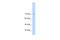 GTF2I Repeat Domain Containing 1 antibody, 29-032, ProSci, Western Blot image 