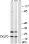 CKLF Like MARVEL Transmembrane Domain Containing 3 antibody, A30613, Boster Biological Technology, Western Blot image 
