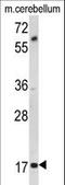 Myelin Associated Oligodendrocyte Basic Protein antibody, LS-C164262, Lifespan Biosciences, Western Blot image 