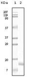 Synuclein Gamma antibody, A03523, Boster Biological Technology, Western Blot image 