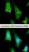 6-Pyruvoyltetrahydropterin Synthase antibody, orb69816, Biorbyt, Immunofluorescence image 