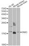 Sorting Nexin 3 antibody, A13380, ABclonal Technology, Western Blot image 