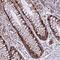 Armadillo Repeat Containing X-Linked 6 antibody, PA5-60206, Invitrogen Antibodies, Immunohistochemistry frozen image 