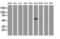 Glucosylceramidase Beta 3 (Gene/Pseudogene) antibody, M08549, Boster Biological Technology, Western Blot image 