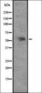 Atypical Chemokine Receptor 3 antibody, orb335157, Biorbyt, Western Blot image 