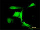 COP1 E3 Ubiquitin Ligase antibody, H00064326-M01, Novus Biologicals, Immunofluorescence image 