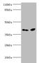 Ciliary neurotrophic factor receptor subunit alpha antibody, A50133-100, Epigentek, Western Blot image 