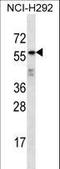 Outer Dense Fiber Of Sperm Tails 2 Like antibody, LS-C163105, Lifespan Biosciences, Western Blot image 