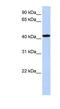 Transcriptional Adaptor 1 antibody, NBP1-56629, Novus Biologicals, Western Blot image 