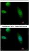 RAD23 Homolog B, Nucleotide Excision Repair Protein antibody, NBP2-16825, Novus Biologicals, Immunofluorescence image 