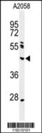 Endonuclease 8-like 1 antibody, 64-067, ProSci, Western Blot image 