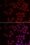 Cold Inducible RNA Binding Protein antibody, LS-C334809, Lifespan Biosciences, Immunofluorescence image 