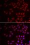 CIRBP antibody, LS-C334809, Lifespan Biosciences, Immunofluorescence image 