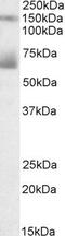 Mesothelin antibody, PA5-19246, Invitrogen Antibodies, Western Blot image 