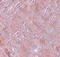 RAN Binding Protein 10 antibody, A09936, Boster Biological Technology, Immunohistochemistry paraffin image 