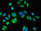 RNA-binding protein with multiple splicing antibody, LS-C377159, Lifespan Biosciences, Immunofluorescence image 