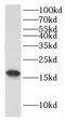 Glia Maturation Factor Beta antibody, FNab03523, FineTest, Western Blot image 