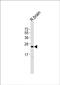 UPII antibody, PA5-49423, Invitrogen Antibodies, Western Blot image 