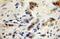 Gamma-Aminobutyric Acid Type A Receptor Gamma1 Subunit antibody, 12871-1-AP, Proteintech Group, Immunohistochemistry paraffin image 