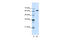 Nuclear RNA Export Factor 1 antibody, 29-372, ProSci, Western Blot image 