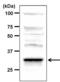 Protein Phosphatase 2 Catalytic Subunit Alpha antibody, PA5-29754, Invitrogen Antibodies, Western Blot image 