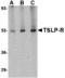 Cytokine Receptor Like Factor 2 antibody, MBS150294, MyBioSource, Western Blot image 