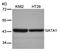GATA Binding Protein 1 antibody, orb14456, Biorbyt, Western Blot image 