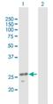 Unc-51 Like Kinase 3 antibody, H00025989-B03P, Novus Biologicals, Western Blot image 