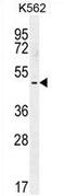 T-box transcription factor TBX6 antibody, AP54189PU-N, Origene, Western Blot image 