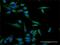 Type II inositol-1,4,5-trisphosphate 5-phosphatase antibody, H00003633-D01P, Novus Biologicals, Immunofluorescence image 