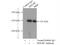 High Density Lipoprotein Binding Protein antibody, 15406-1-AP, Proteintech Group, Immunoprecipitation image 