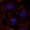 Protein Kinase C Theta antibody, HPA065279, Atlas Antibodies, Immunofluorescence image 