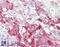 Growth factor receptor-bound protein 10 antibody, 43-389, ProSci, Enzyme Linked Immunosorbent Assay image 