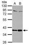 Selenoprotein P antibody, GTX105647, GeneTex, Western Blot image 