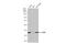 Cyclin Dependent Kinase 6 antibody, GTX103992, GeneTex, Western Blot image 