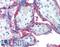 CD59 Molecule (CD59 Blood Group) antibody, LS-B1960, Lifespan Biosciences, Immunohistochemistry paraffin image 