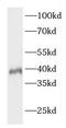 ELOVL Fatty Acid Elongase 4 antibody, FNab02747, FineTest, Western Blot image 